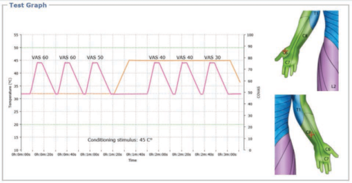 Gráfico Medoc Q-Sense CPM