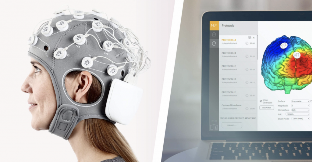 Sistema de tES / EEG